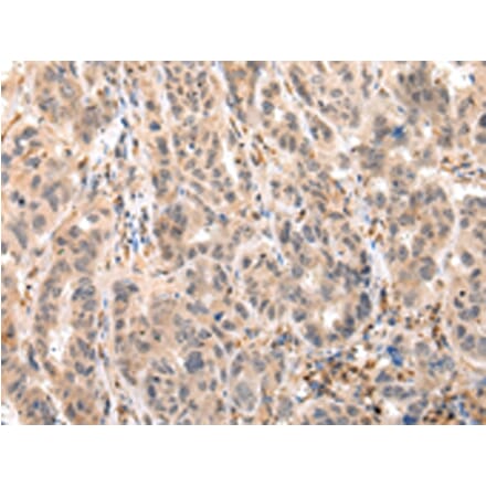Immunohistochemistry - EPHB4 Antibody from Signalway Antibody (43268) - Antibodies.com