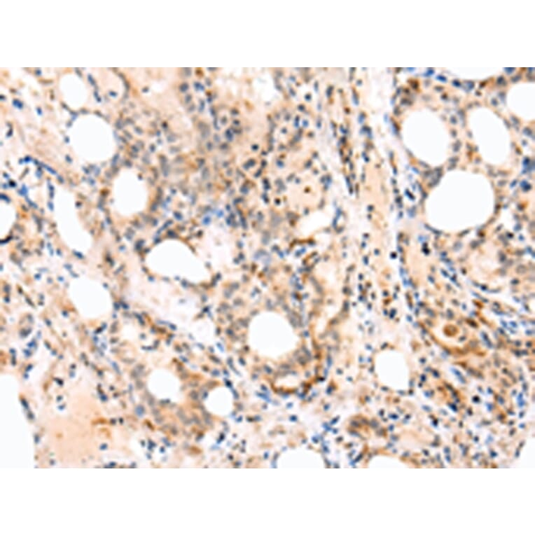 Immunohistochemistry - EPHB4 Antibody from Signalway Antibody (43268) - Antibodies.com