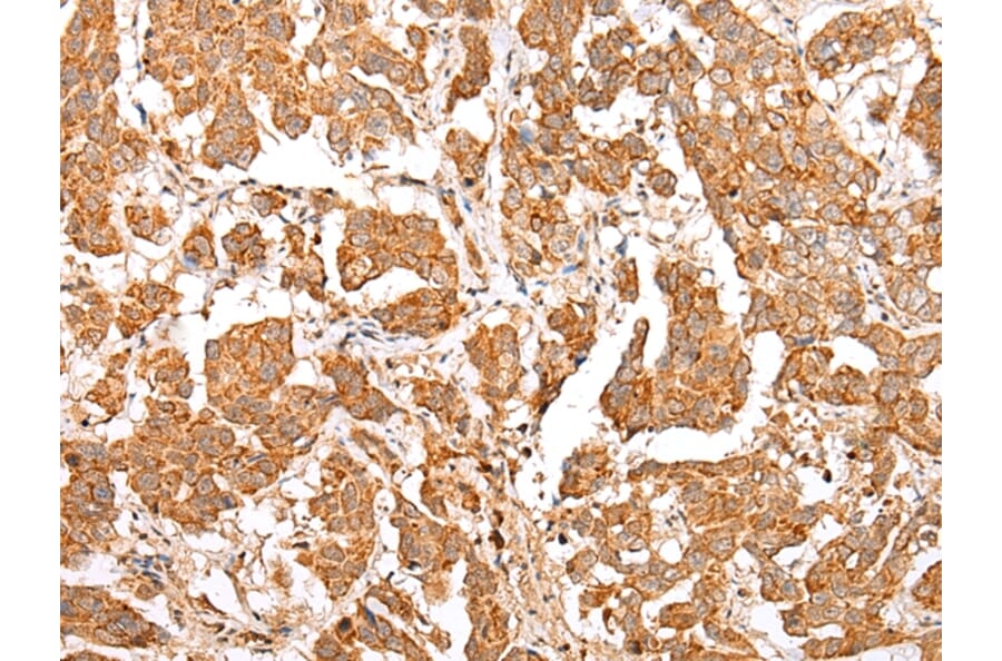 Immunohistochemistry - NLRP1 Antibody from Signalway Antibody (43280) - Antibodies.com