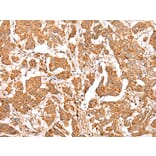 Immunohistochemistry - NLRP1 Antibody from Signalway Antibody (43280) - Antibodies.com