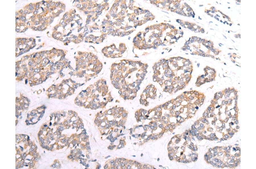 Immunohistochemistry - HTR1B Antibody from Signalway Antibody (43284) - Antibodies.com