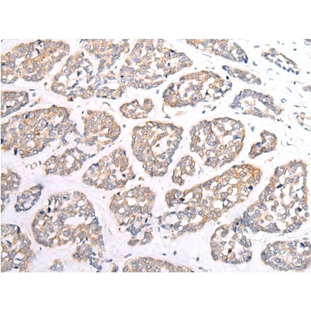Immunohistochemistry - HTR1B Antibody from Signalway Antibody (43284) - Antibodies.com