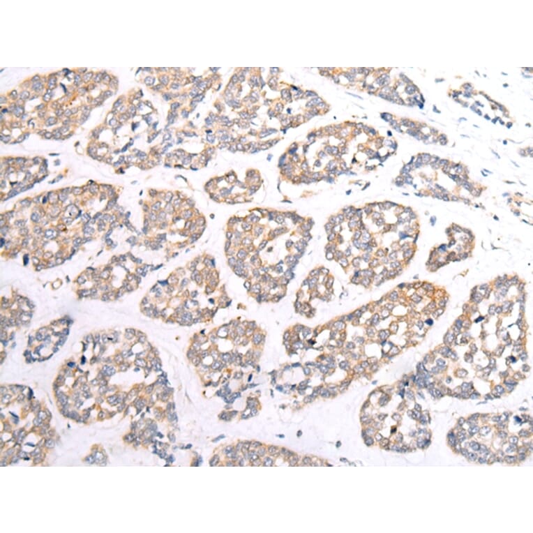 Immunohistochemistry - HTR1B Antibody from Signalway Antibody (43284) - Antibodies.com