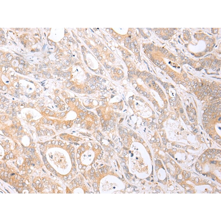 Immunohistochemistry - HTR1B Antibody from Signalway Antibody (43284) - Antibodies.com