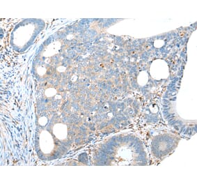 Immunohistochemistry - TRPV6 Antibody from Signalway Antibody (43287) - Antibodies.com