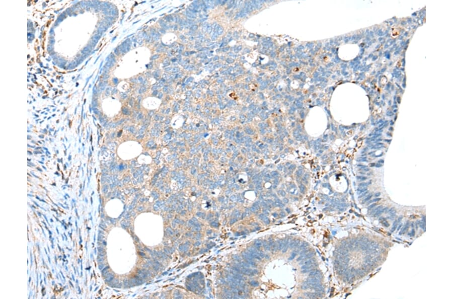 Immunohistochemistry - TRPV6 Antibody from Signalway Antibody (43287) - Antibodies.com