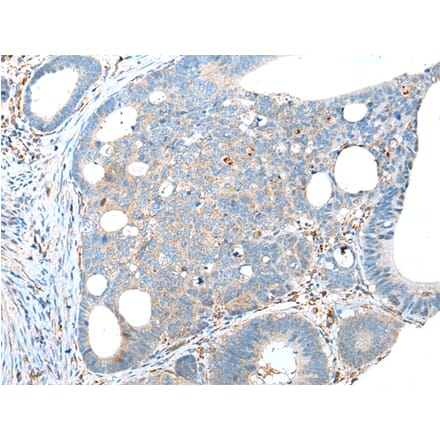 Immunohistochemistry - TRPV6 Antibody from Signalway Antibody (43287) - Antibodies.com