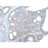 Immunohistochemistry - TRPV6 Antibody from Signalway Antibody (43287) - Antibodies.com