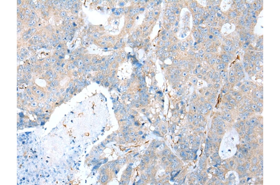 Immunohistochemistry - TRPV6 Antibody from Signalway Antibody (43287) - Antibodies.com