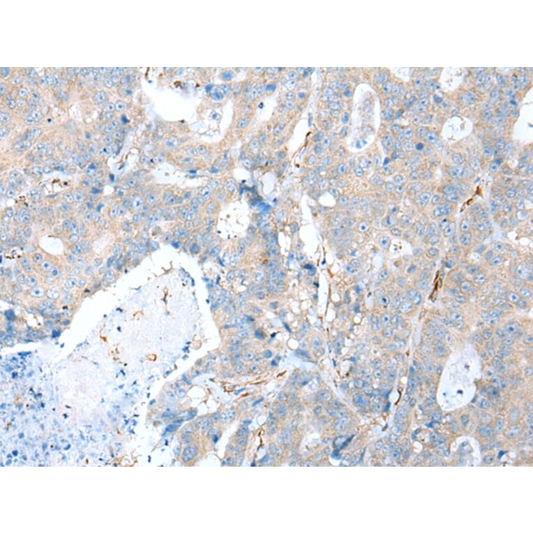 Immunohistochemistry - TRPV6 Antibody from Signalway Antibody (43287) - Antibodies.com