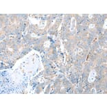 Immunohistochemistry - TRPV6 Antibody from Signalway Antibody (43287) - Antibodies.com