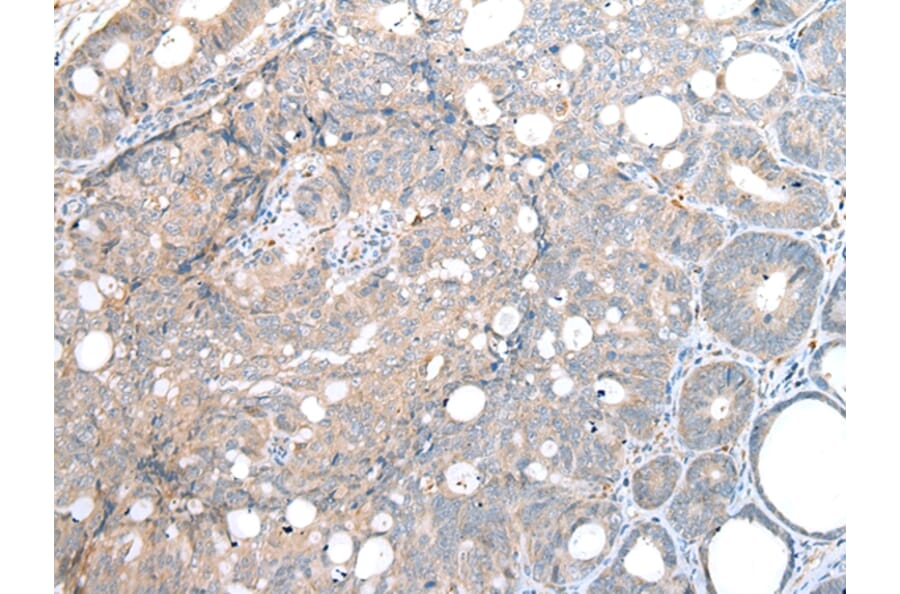 Immunohistochemistry - DAPK3 Antibody from Signalway Antibody (43288) - Antibodies.com