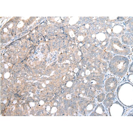 Immunohistochemistry - DAPK3 Antibody from Signalway Antibody (43288) - Antibodies.com