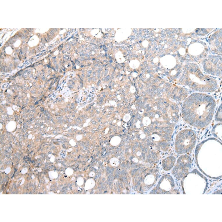 Immunohistochemistry - DAPK3 Antibody from Signalway Antibody (43288) - Antibodies.com