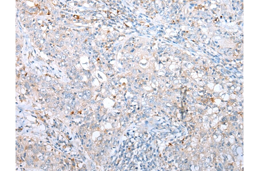 Immunohistochemistry - DAPK3 Antibody from Signalway Antibody (43288) - Antibodies.com
