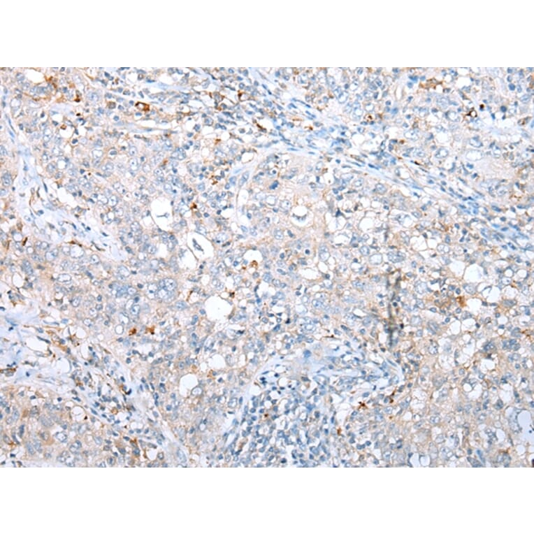 Immunohistochemistry - DAPK3 Antibody from Signalway Antibody (43288) - Antibodies.com