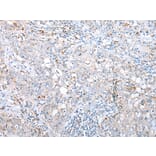 Immunohistochemistry - DAPK3 Antibody from Signalway Antibody (43288) - Antibodies.com