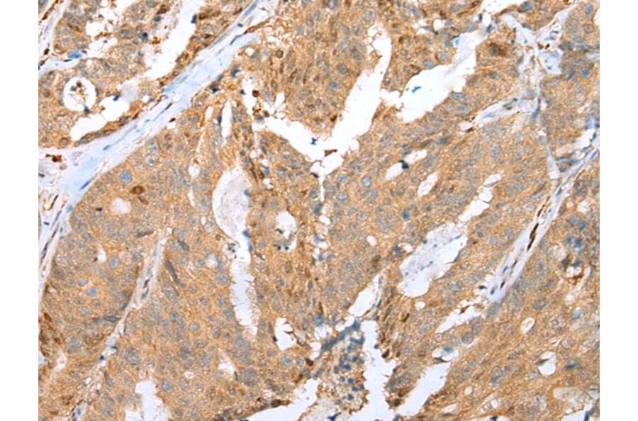 Immunohistochemistry - CCNG2 Antibody from Signalway Antibody (43290) - Antibodies.com