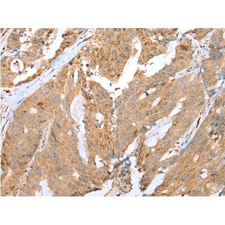 Immunohistochemistry - CCNG2 Antibody from Signalway Antibody (43290) - Antibodies.com