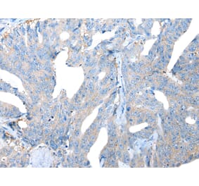 Immunohistochemistry - LAMP1 Antibody from Signalway Antibody (43295) - Antibodies.com