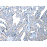 Immunohistochemistry - LAMP1 Antibody from Signalway Antibody (43295) - Antibodies.com