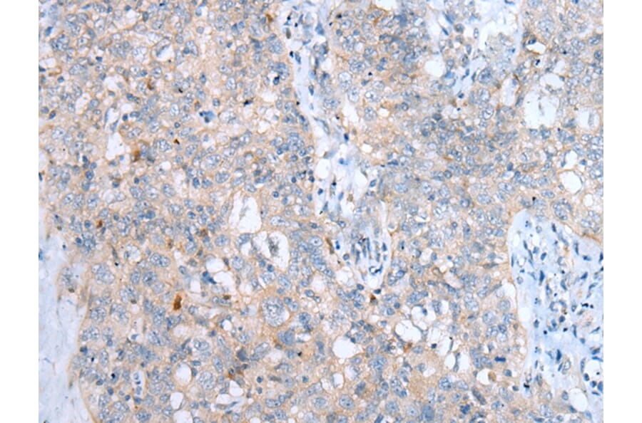 Immunohistochemistry - LAMP1 Antibody from Signalway Antibody (43295) - Antibodies.com