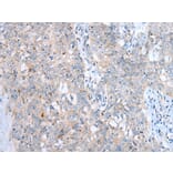 Immunohistochemistry - LAMP1 Antibody from Signalway Antibody (43295) - Antibodies.com