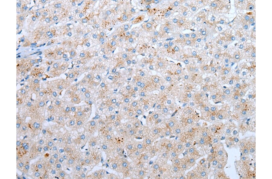 Immunohistochemistry - CD209 Antibody from Signalway Antibody (43296) - Antibodies.com