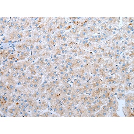 Immunohistochemistry - CD209 Antibody from Signalway Antibody (43296) - Antibodies.com