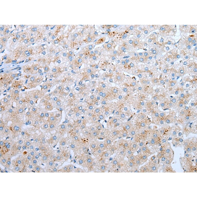 Immunohistochemistry - CD209 Antibody from Signalway Antibody (43296) - Antibodies.com