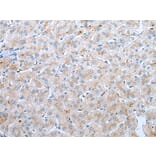 Immunohistochemistry - CD209 Antibody from Signalway Antibody (43296) - Antibodies.com