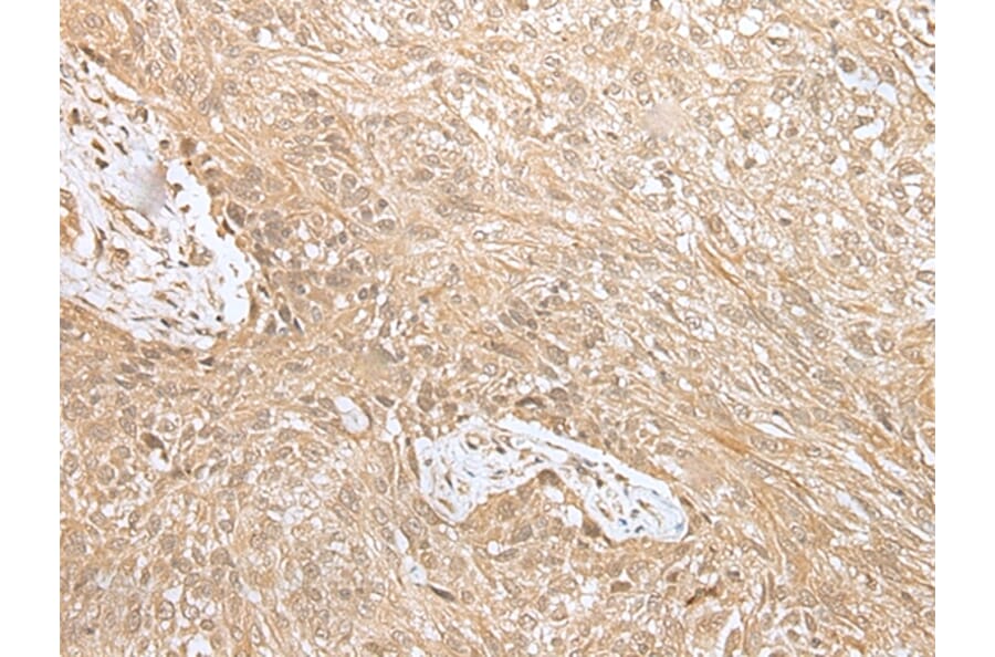 Immunohistochemistry - NPHS1 Antibody from Signalway Antibody (43306) - Antibodies.com