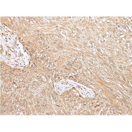 Immunohistochemistry - NPHS1 Antibody from Signalway Antibody (43306) - Antibodies.com