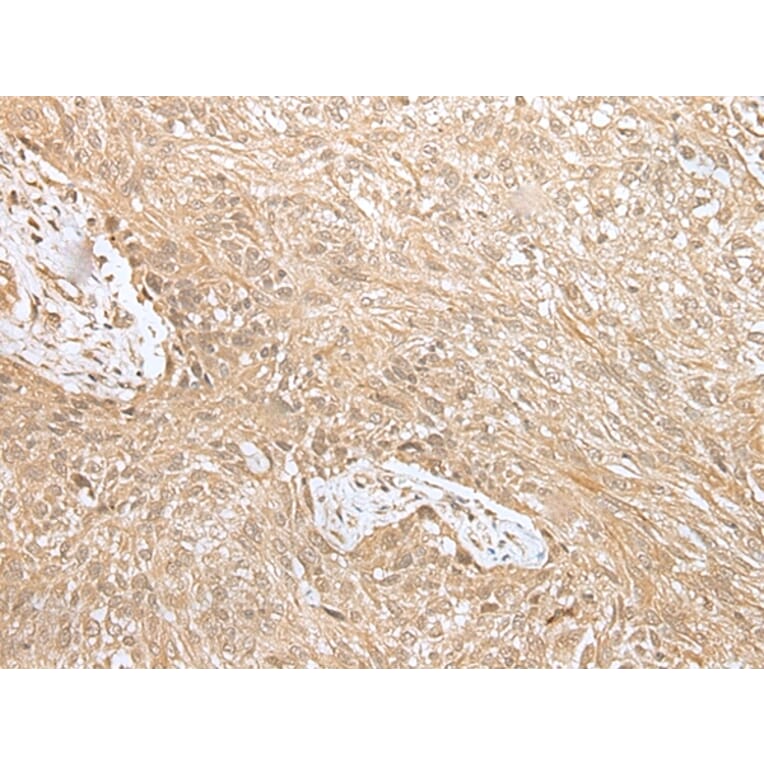 Immunohistochemistry - NPHS1 Antibody from Signalway Antibody (43306) - Antibodies.com
