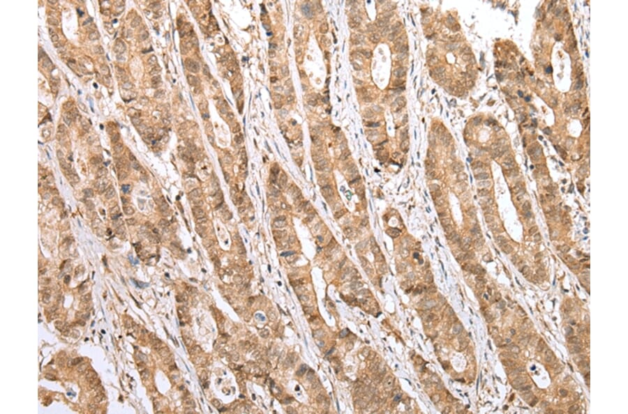 Immunohistochemistry - STAT3 Antibody from Signalway Antibody (43315) - Antibodies.com