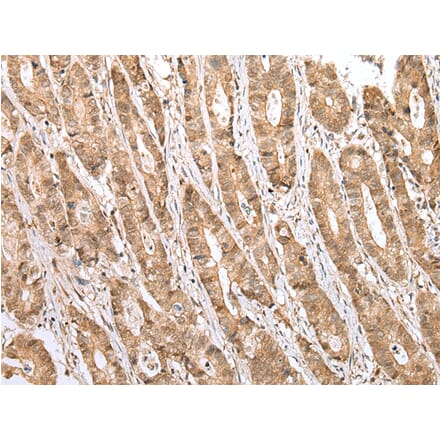 Immunohistochemistry - STAT3 Antibody from Signalway Antibody (43315) - Antibodies.com