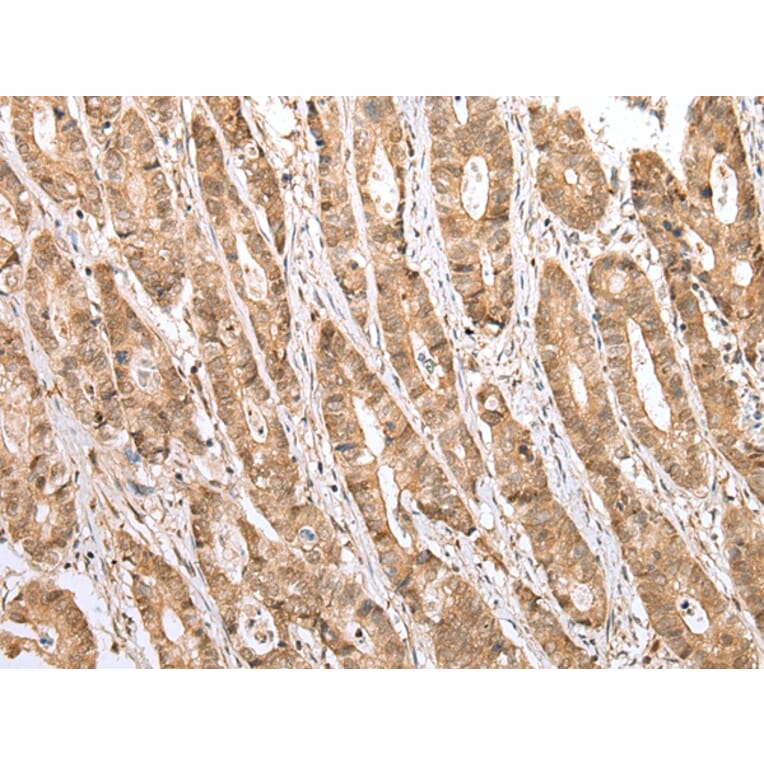 Immunohistochemistry - STAT3 Antibody from Signalway Antibody (43315) - Antibodies.com