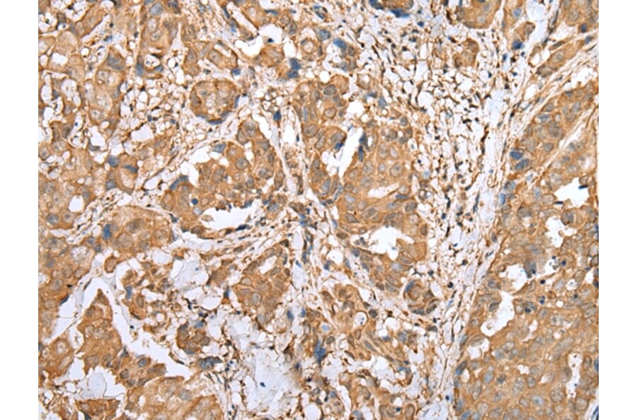 Immunohistochemistry - STAT3 Antibody from Signalway Antibody (43315) - Antibodies.com