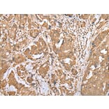 Immunohistochemistry - STAT3 Antibody from Signalway Antibody (43315) - Antibodies.com