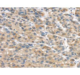 Immunohistochemistry - GLP2R Antibody from Signalway Antibody (43319) - Antibodies.com