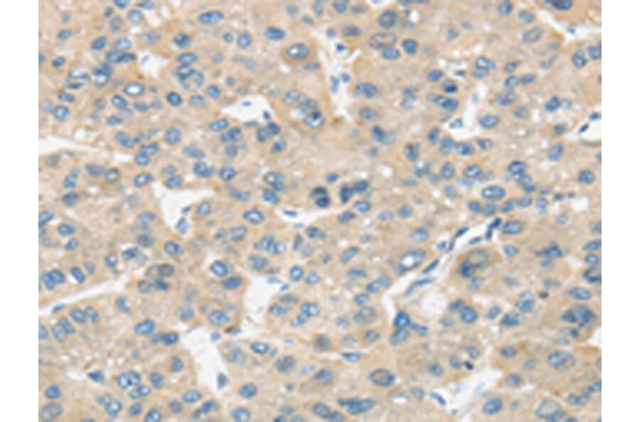 Immunohistochemistry - TIRAP Antibody from Signalway Antibody (43336) - Antibodies.com
