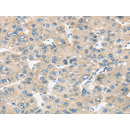 Immunohistochemistry - TIRAP Antibody from Signalway Antibody (43336) - Antibodies.com