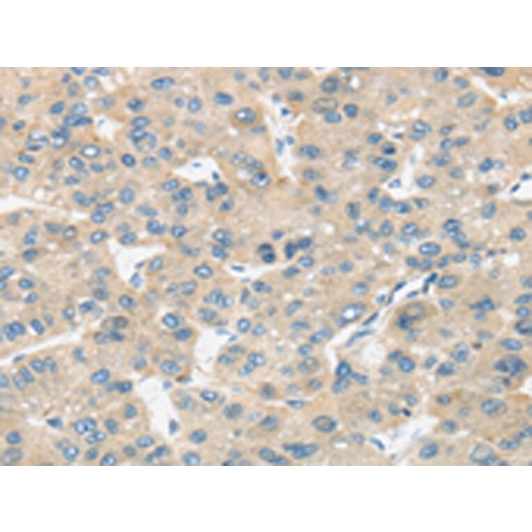 Immunohistochemistry - TIRAP Antibody from Signalway Antibody (43336) - Antibodies.com