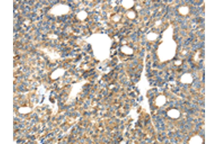 Immunohistochemistry - TIRAP Antibody from Signalway Antibody (43336) - Antibodies.com