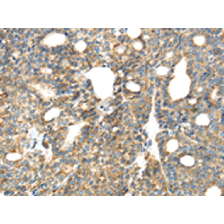 Immunohistochemistry - TIRAP Antibody from Signalway Antibody (43336) - Antibodies.com