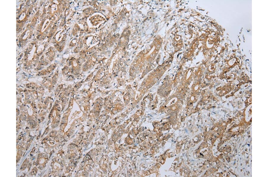 Immunohistochemistry - ZNF23 Antibody from Signalway Antibody (43350) - Antibodies.com