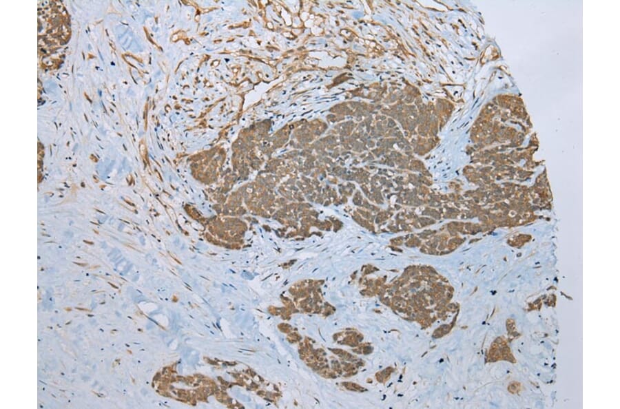 Immunohistochemistry - ZNF23 Antibody from Signalway Antibody (43350) - Antibodies.com