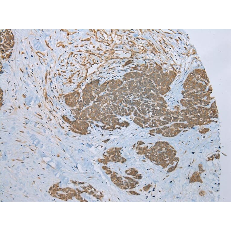 Immunohistochemistry - ZNF23 Antibody from Signalway Antibody (43350) - Antibodies.com