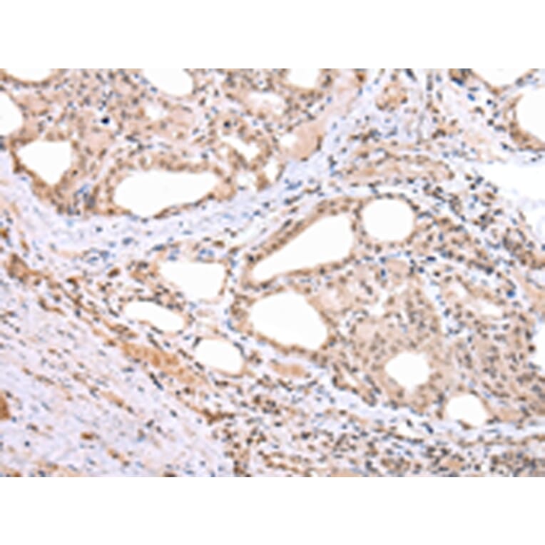 Immunohistochemistry - ARL17 Antibody from Signalway Antibody (43352) - Antibodies.com