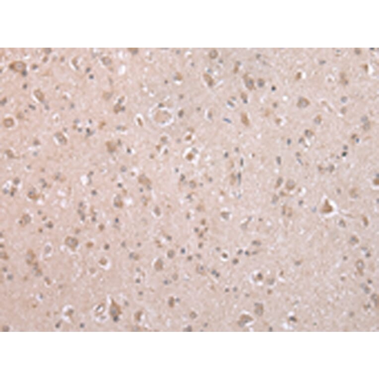 Immunohistochemistry - ARL17 Antibody from Signalway Antibody (43352) - Antibodies.com